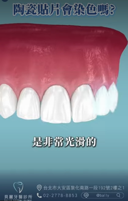 其實陶瓷貼片表面非常光滑