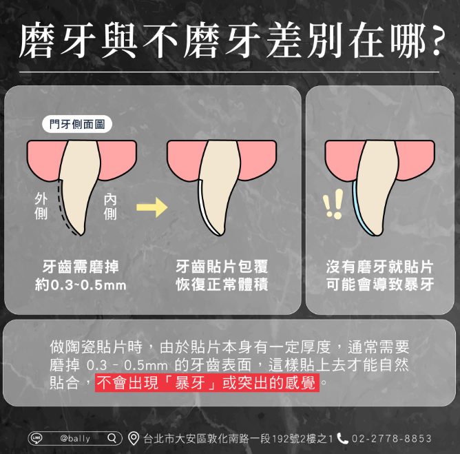 磨牙與不磨牙差別在哪？